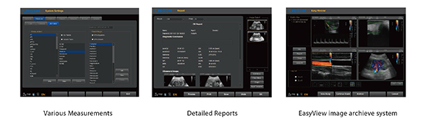 CHISON I9 image - Chison i9 ultrasound for sale