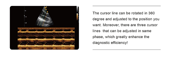 CHISON I9 Cost - Chison ultrasound image