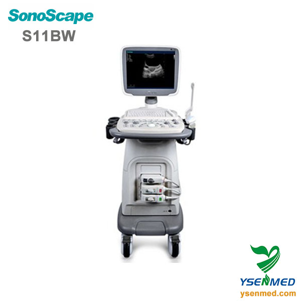 SonoScape S11 BW trolley black and white ultrasound scanner
