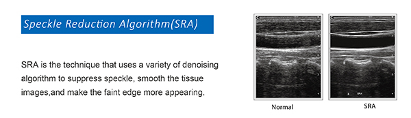 CHISON I9 image - Chison ultrasound for sale