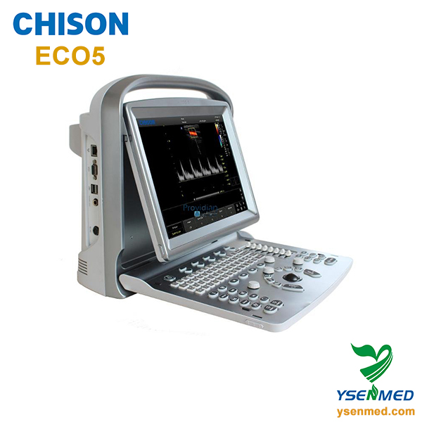 CHISON ECO5 Ccolor Doppler Ultrasound Machine Sell To Haiti