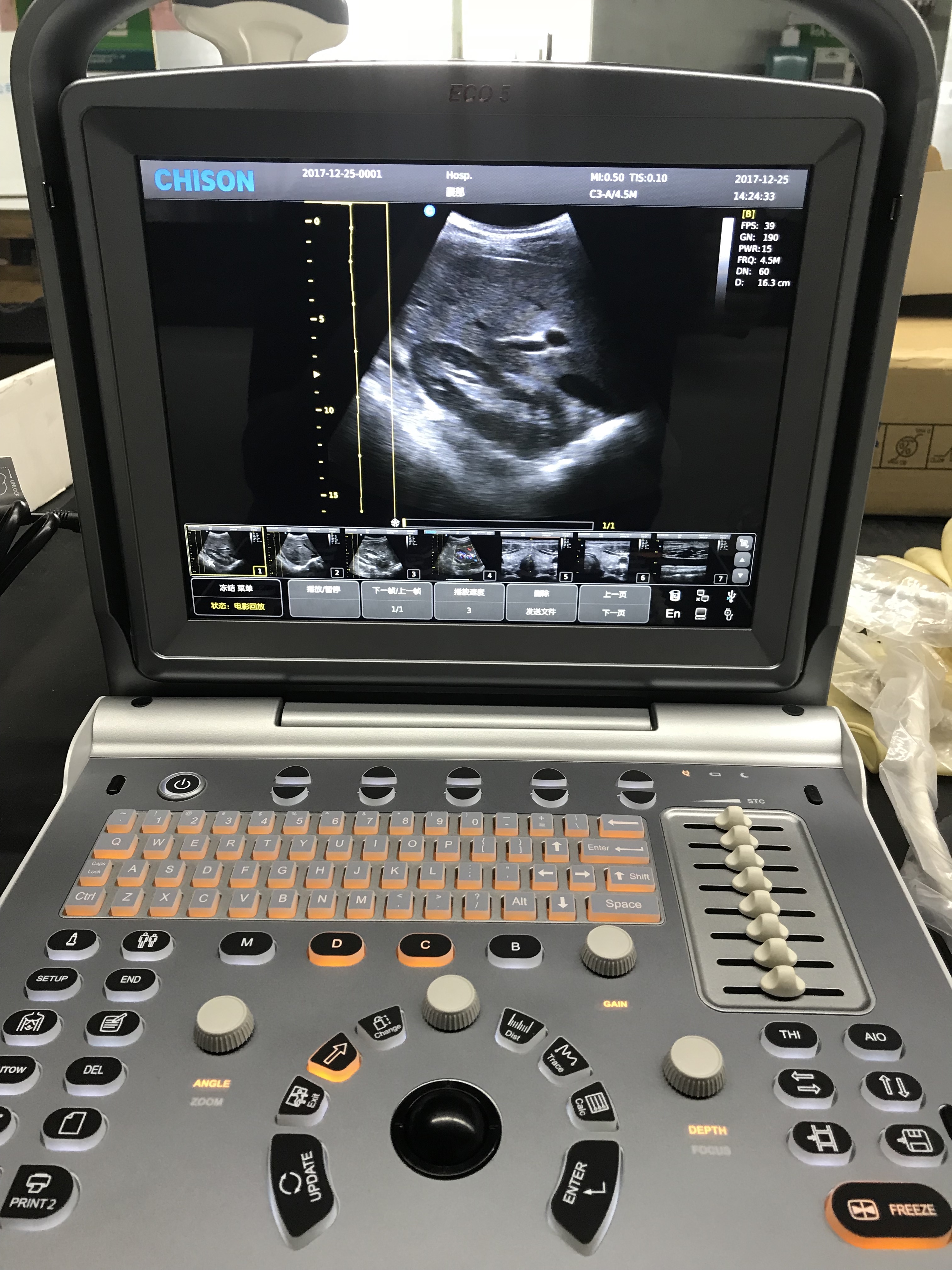 CHISON ECO5 Ccolor Doppler Ultrasound Machine in Haiti