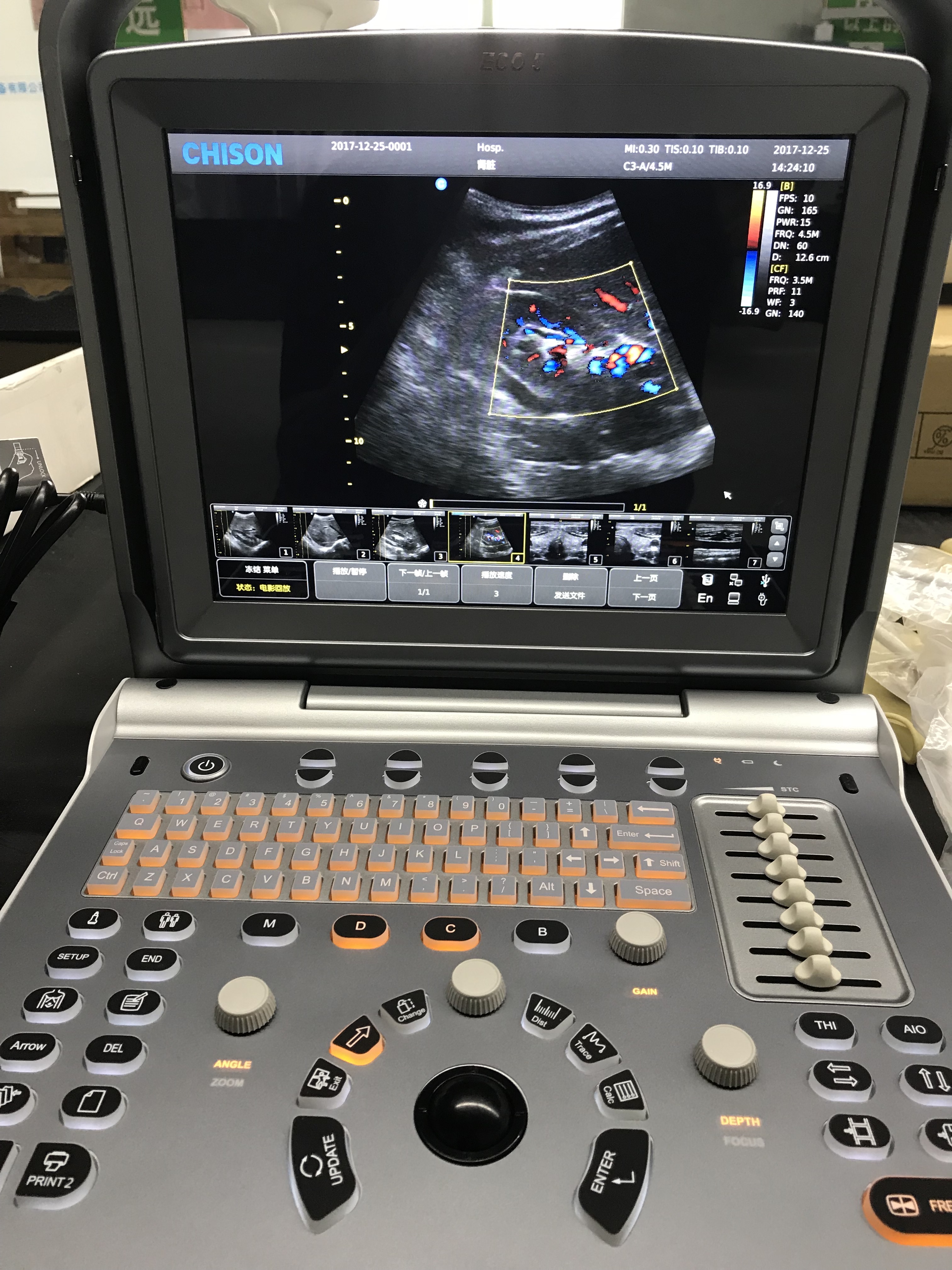 CHISON ECO5 Ccolor Doppler Ultrasound Machine in Haiti