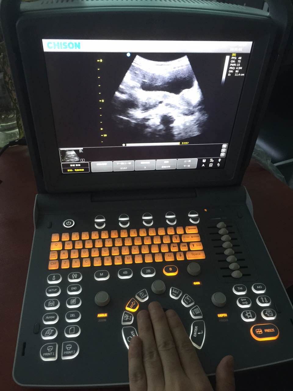 CHISON ECO1 B/W Portable Ultrasound Machine