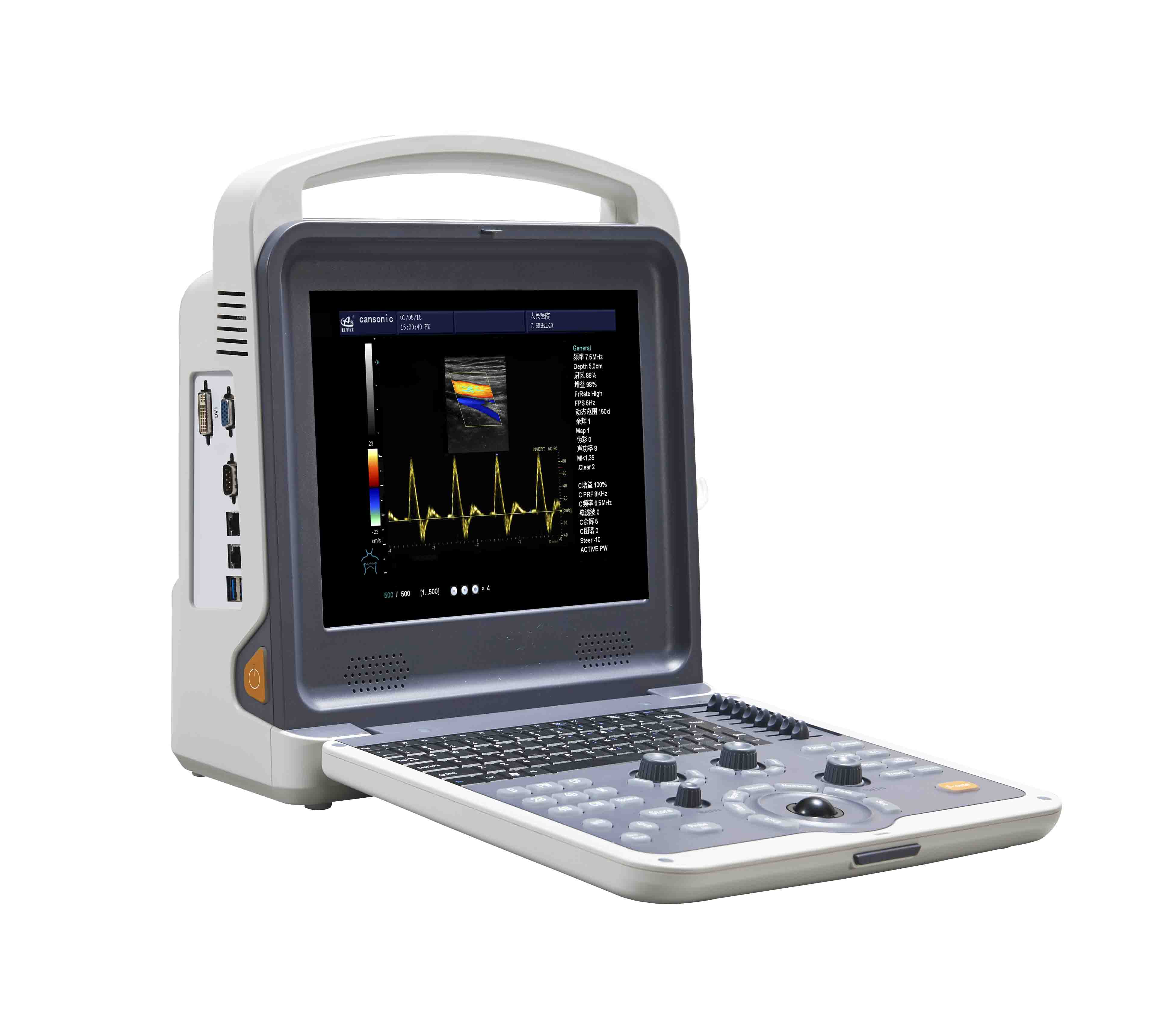 Veterinary Portable color doppler ultrasound YSB-K2000V