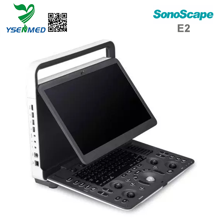 Sonoscape E2 - Scanner échographique portable Sonoscape E2 Prix