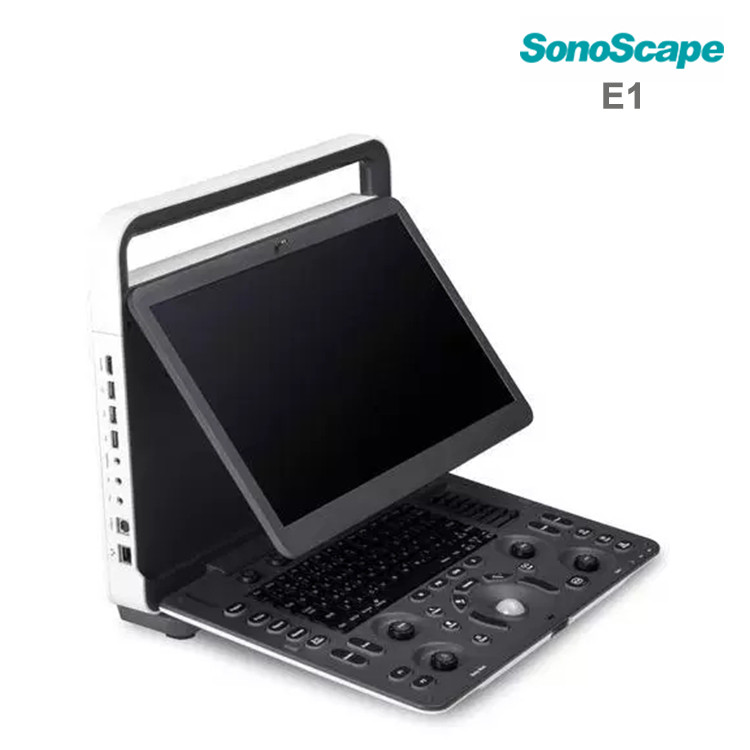 Sonoscape E1 prix -扫描仪échographique E1 portatif N / B