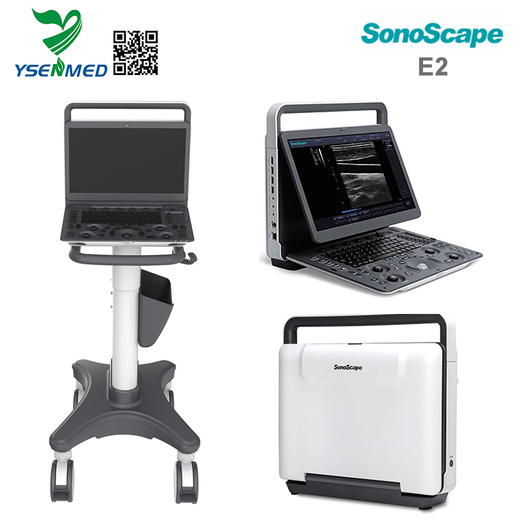 Sonoscape E2  -  Sonoscape便携式彩色超声扫描仪E2价格