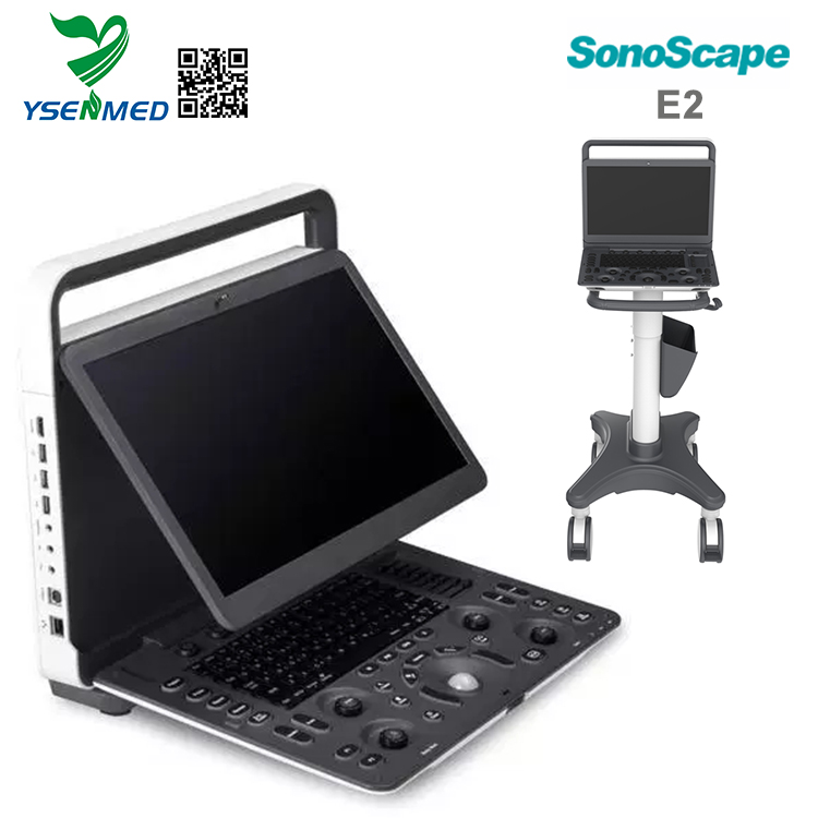Sonoscape E2 - Sonoscape Portable Color Ultrasound Scanner E2 Price