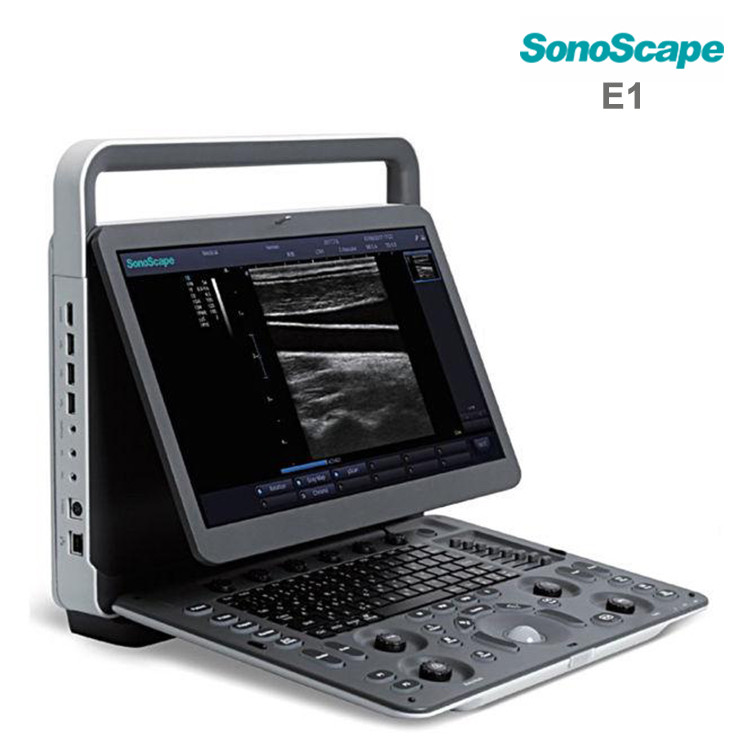 Sonoscape E1 prix - Scanner échographique E1 portatif N / B