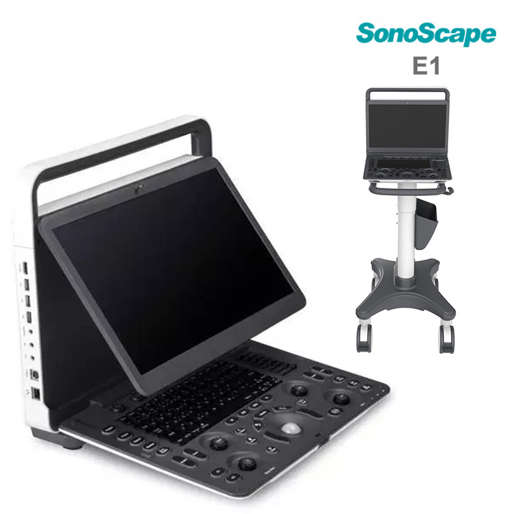 Sonoscape E1 - Sonoscape Portable B/W Ultrasound Scanner E1 For Sale ...