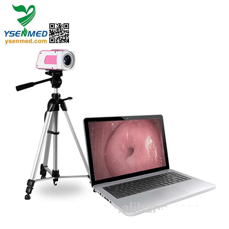 Portable digital colposcope YSSW3301 