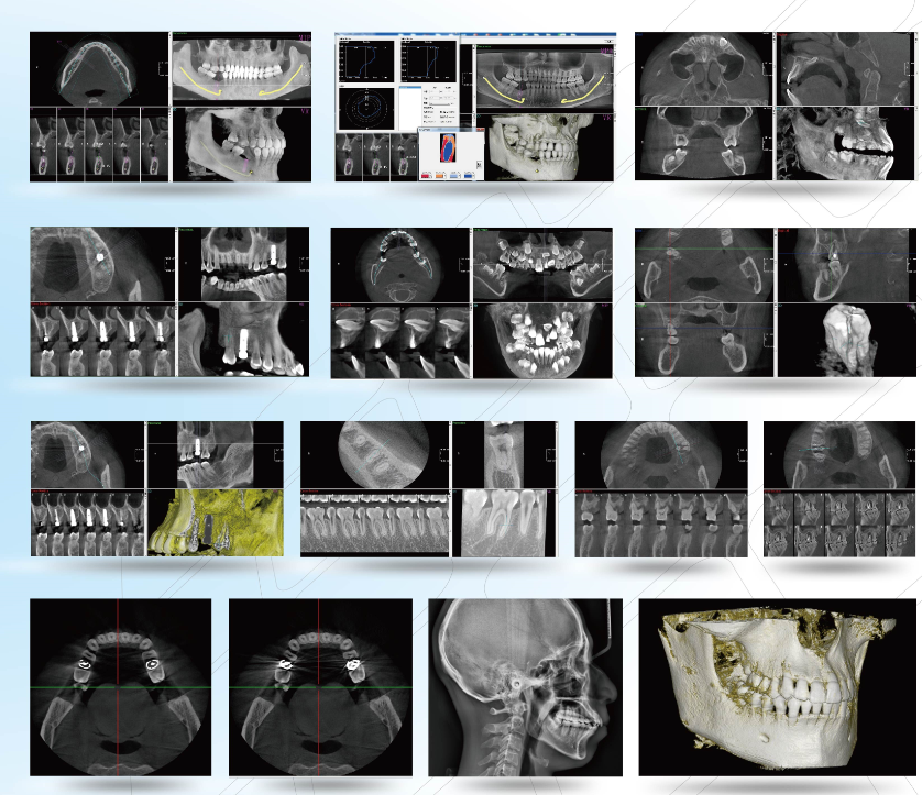 Panorama Dental X射线​​机YSX1005E