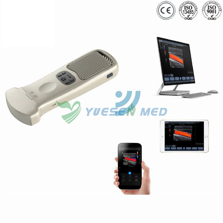 Palm Wireless color ultrasound system YSB363