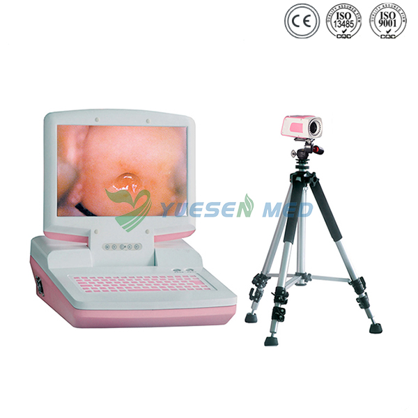 Portable Digital Colposcope  YSSW3301