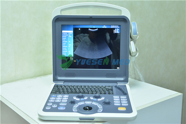 Portable color doppler ultrasound sell to Côte d'Ivoire