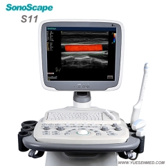 Máquina de ultrassom Doppler colorido para carrinho Sonoscape S11