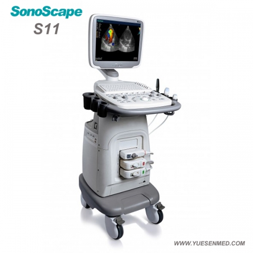 Trolley Color Doppler Ultrasound Machine Sonoscape S11