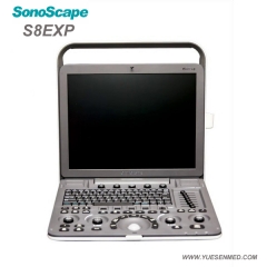 Sonoscape S8Exp Portable Color Doppler超声S8EXP