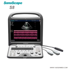 Sonoscape S8 échographie doppler couleur portable S8