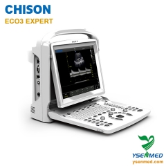 Máquina de ultrassom Chison ECO3 ESPECIALISTA