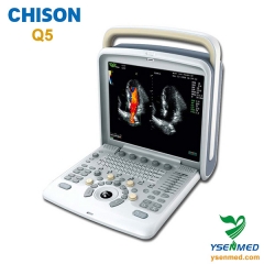Sistema de ultrasonido Doppler color CHISON Q5