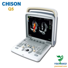 Color Doppler ultrasound system CHISON Q5