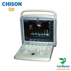 Portable color Doppler ultrasound CHISON Q9