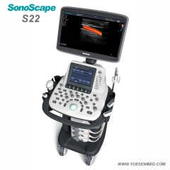 Carrinho cor多普勒ultrassom preço SonoScape S22