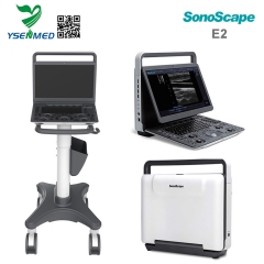 Sonoscape E2 - Escáner de ultrasonido portátil en color Sonoscape E2