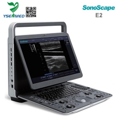 Sonoscape E2  -  Sonoscape便携式彩色超声扫描仪E2