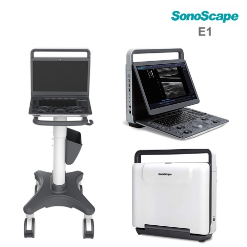 Sonoscape E1 - Sonoscape portátil B/W escáner de ultrasonido E1