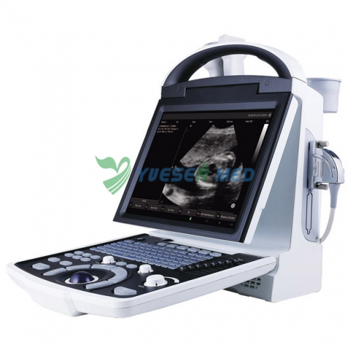 Portable B/W Ultrasound Scanner YSB5533