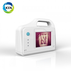 IN-G091 Clinical Vein Transilluminator Vein finder Device