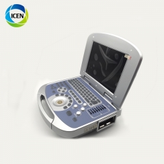 IN-A50 Portable Digital Laptop 2D Echo Ultrasound Scanner Diagnosis Ultrasound Machine