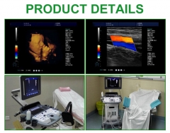 IN-A046 3D/4D ultrasound scanner full digital portable laptop home baby 3D ultrasound machine