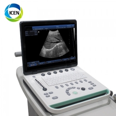 IN-A032-1 Full digital laptop Portable mechanical vascular doppler ultrasound scanner