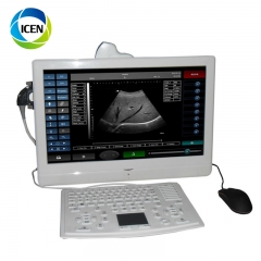 IN-A006 Hospital machine medical portable pregnancy wireless best ultrasound scanner