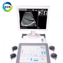 IN-A2018CII Chison ultrasound trolley ultrasound gel machine with convex probe