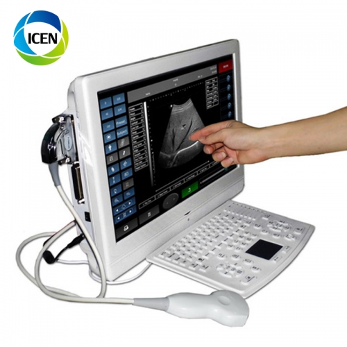 IN-A006 Hospital machine medical portable pregnancy wireless best ultrasound scanner