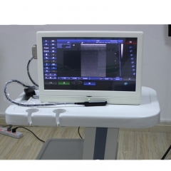 IN-A006 Hospital machine medical portable pregnancy wireless best ultrasound scanner