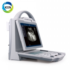 IN-A5600 Portable medical diagnostic system medical digital ultrasound machine price