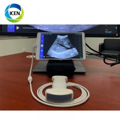 IN-UCL Portable Ultrasound Machine USB Dual Head Echo Android Ultrasound Probe