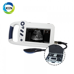 IN-A80 Home Supersonic touch Ultrasound Machine Usg 2D Scanner Usb Vet Ultrasound Device