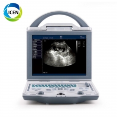 IN-A5600 Portable medical diagnostic system medical digital ultrasound machine price