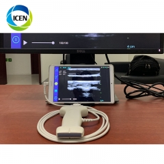 IN-UCL Portable Ultrasound Machine USB Dual Head Echo Android Ultrasound Probe