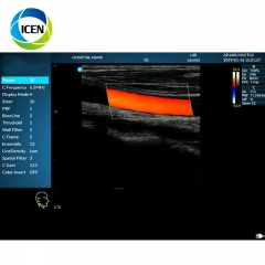 IN-AK0 Portable Ultrasound Machine Vet Ecografo for Veterinary