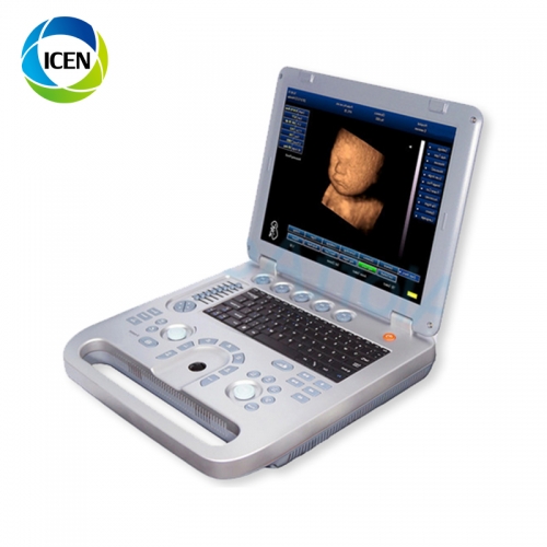 IN-A8 Portable Ecografo 3D 4D Color Doppler Ultrasound Scanner Usg Machine Sonography