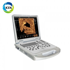 IN-AC60PLUS 3D 4D 5D Portable Notebook/Laptop Dopler Echo Wed Ultrasound Baby Scanner Machine