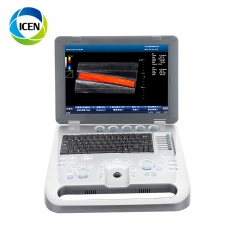 IN-A8 Portable Ecografo 3D 4D Color Doppler Ultrasound Scanner Usg Machine Sonography